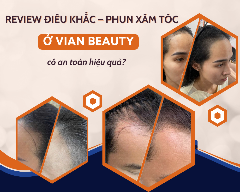 review vian dieu khac toc
