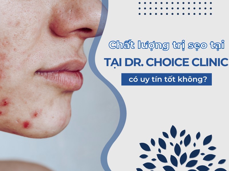 Trị Sẹo Ở Dr. Choice Clinic: Tất Cả Những Gì Bạn Cần Biết